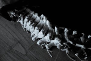 Spinal Cord Horizontal